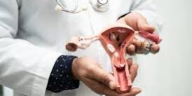 cancer cervicouterino